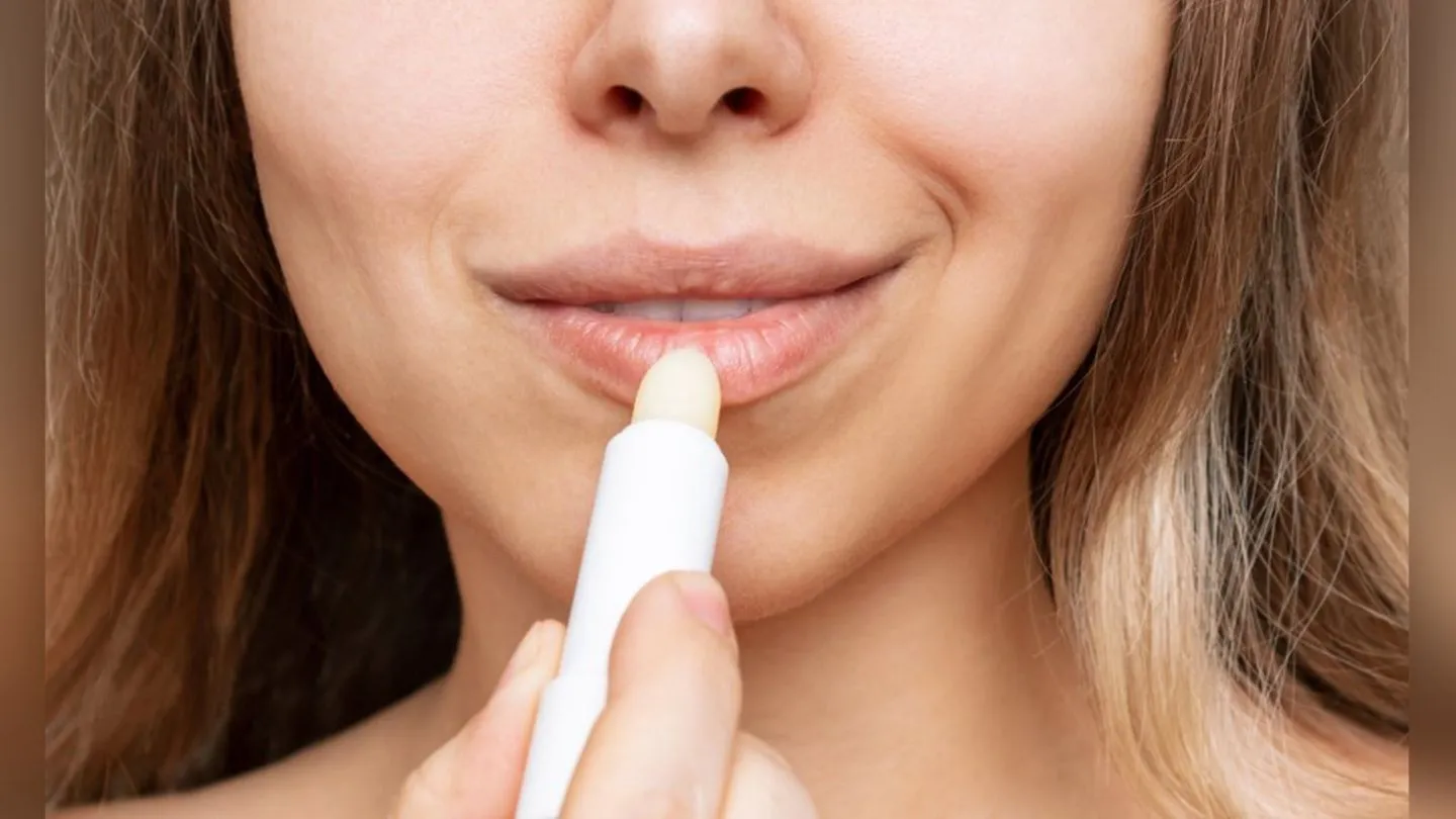 Rissige und trockene Lippen: Diese Pflegefehler können die Beschwerden verschlimmern